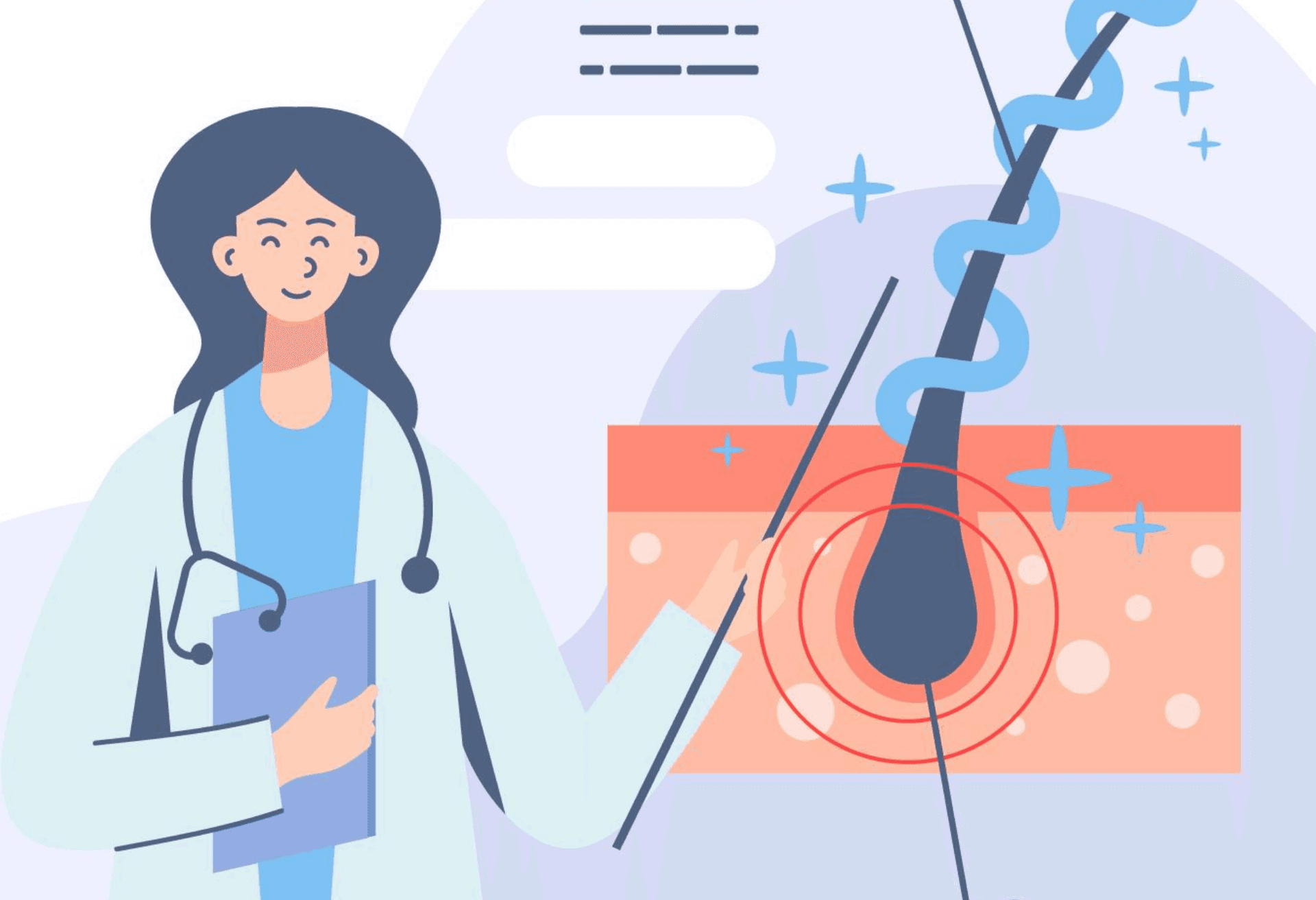 i-Direct 植髮技術 — 醫生與毛囊示意圖