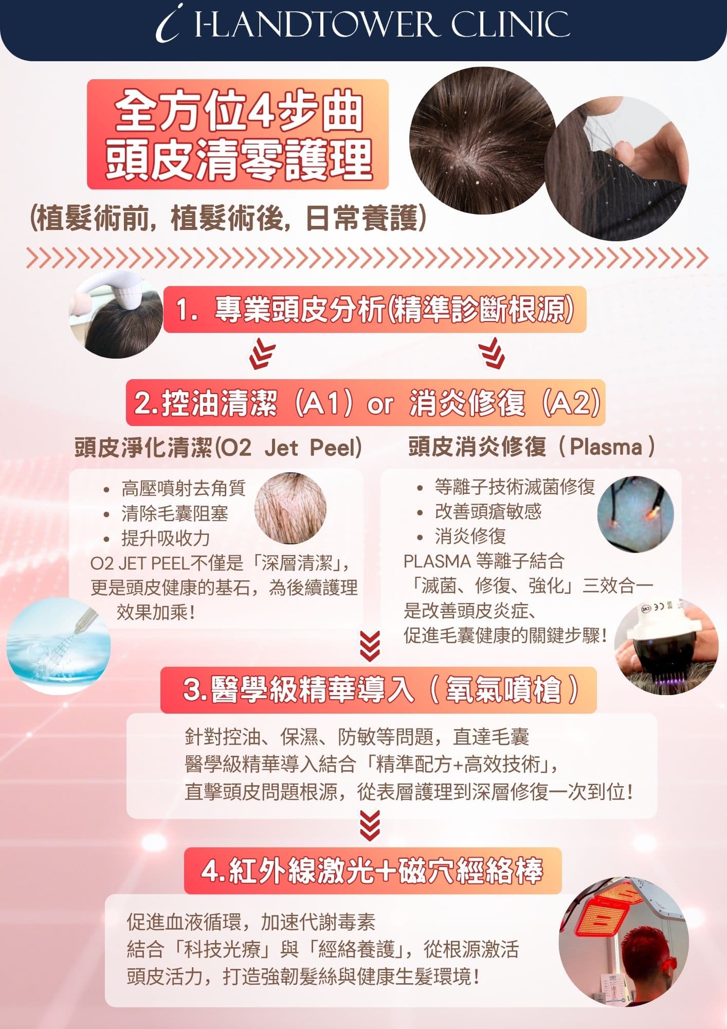 全方位4步曲頭皮清零護理流程總覽