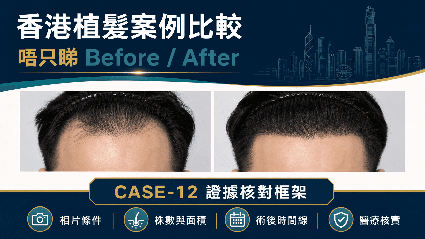香港植髮案例比較,醫療人員與客人核對標準化頭皮相片